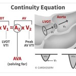 Aortic Valve Area Continuity Equation Using Vti